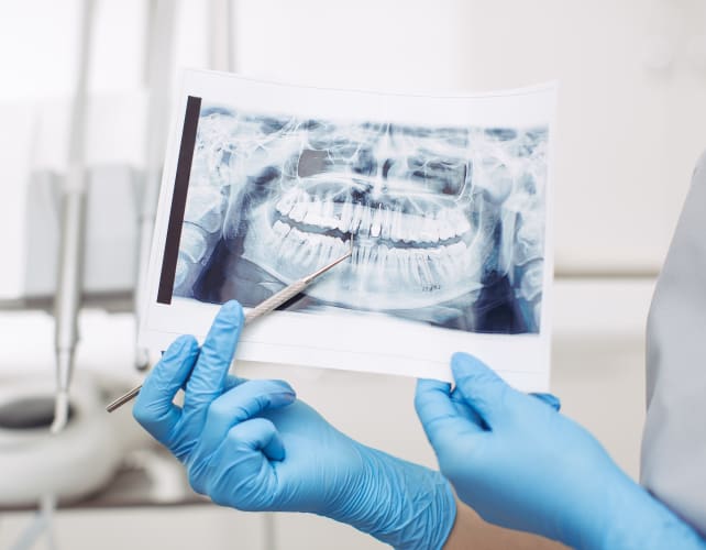 X-Ray Technology, Kitchener Dentist