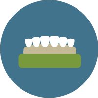 Crowns and Bridges, Country Hills Dentistry, Kitchener
